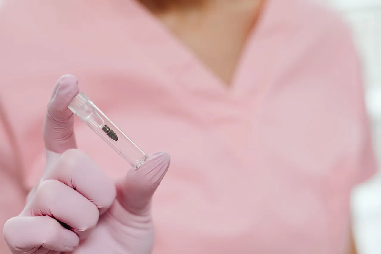 Titanium dental implant post — the same internationally manufactured implants used by top UK clinics, available in Antalya at 70–80% lower cost