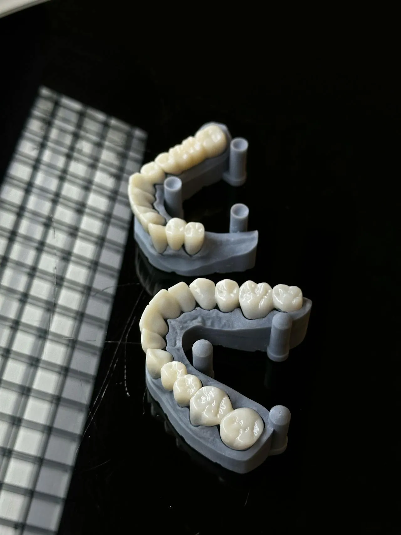 Zirconia crown produced in a dental laboratory — the same premium material used at top UK private clinics, made in Antalya